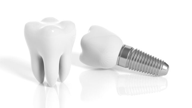 Dental Implants Turkey